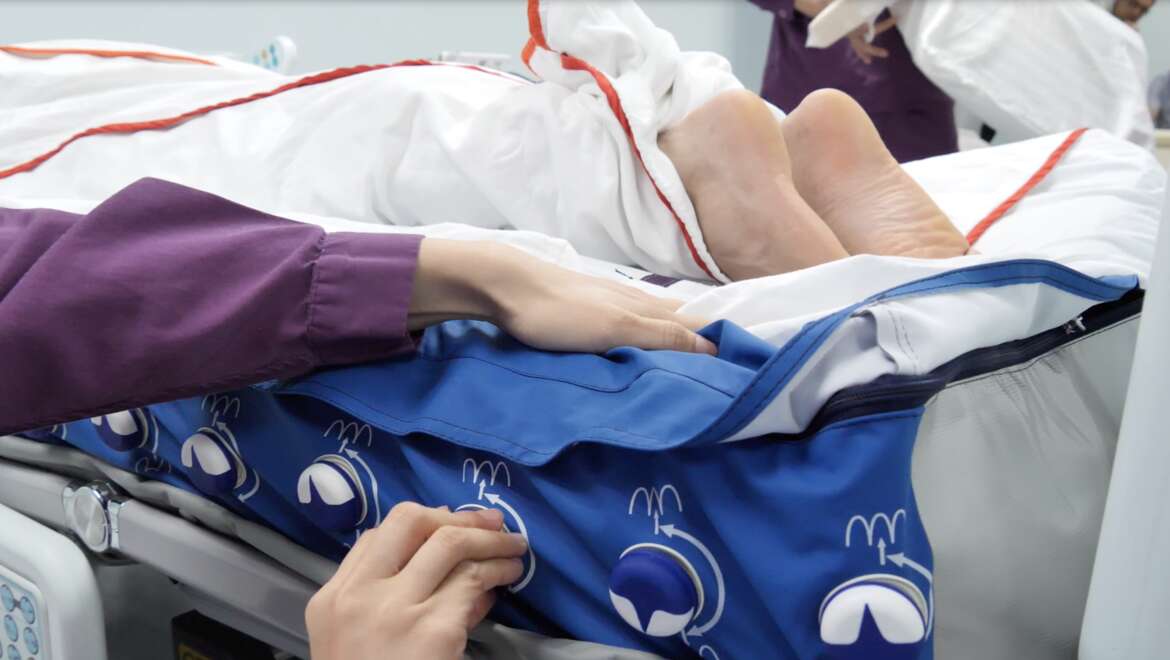 Pressure injuries are a preventable medical condition, usually caused by immobility in bedridden patients, developed by one out of two patients in acute care. Due to the excessive financial, economic and psychological cost of pressure injuries, there is considerable “pressure” on healthcare systems to reduce incidences of the condition.